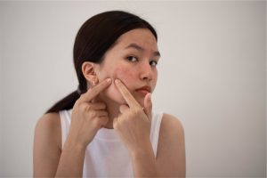 Jeune femme examinant des boutons d'acné sur sa joue